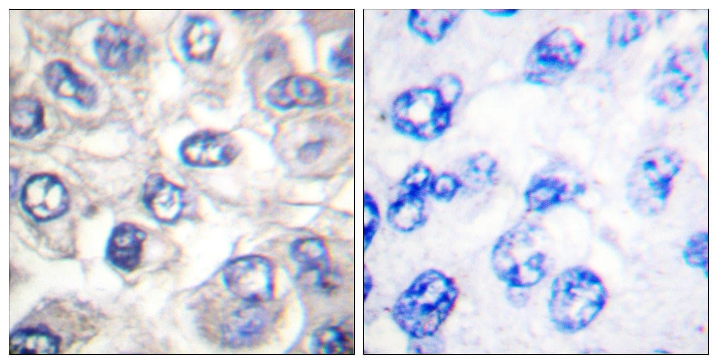 Polyclonal Rabbit anti-Mouse BAD Antibody (Cleaved-Asp71, IHC, WB)