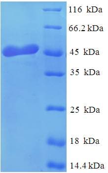 Human Osteoglycin / Mimecan Protein (Recombinant His)