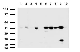 TP / Thymidine Phosphorylase Antibody (aa311-482, clone UMAB98)