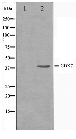 Polyclonal Rabbit anti-Human CDK7 Antibody (IHC, WB)