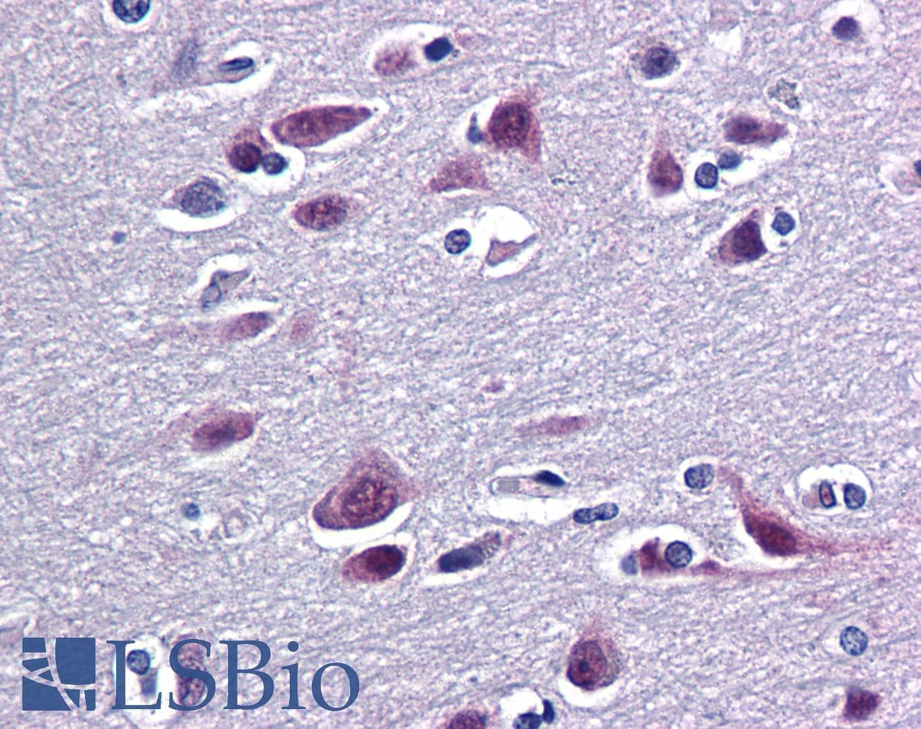 IHC-plus™ RBFOX2 / RBM9 Antibody (clone 4G3)