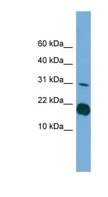 Polyclonal Rabbit anti-Human IL36RN / IL1F5 Antibody (C-Terminus, WB)