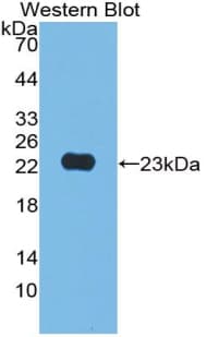 JAM2 Antibody (aa74-250, APC)