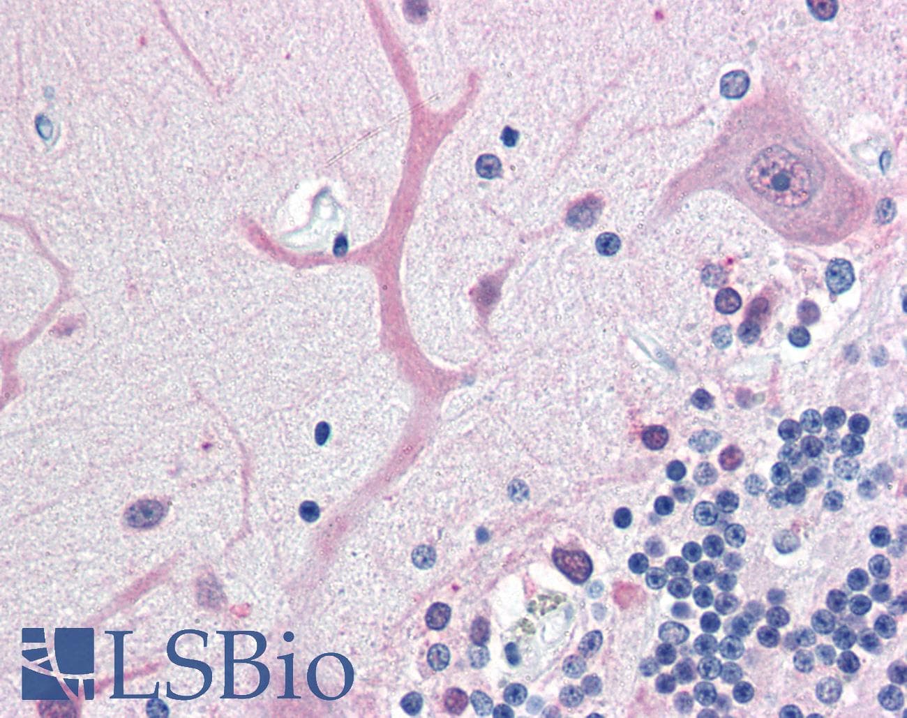 IHC-plus™ Polyclonal Chicken anti-Human UCHL1 / PGP9.5 Antibody (IHC, IF, WB)
