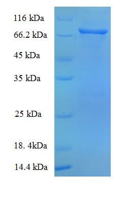 Cynomolgus monkey ALB / Serum Albumin Protein (Recombinant 6His, N-terminus)