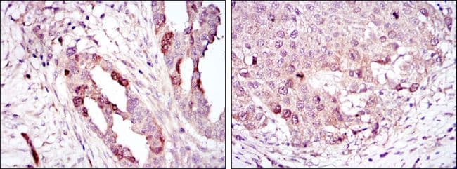 AURKA / Aurora-A Antibody (clone 4G10)