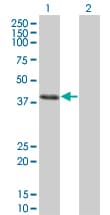 CLN3 Antibody (clone 1G10)