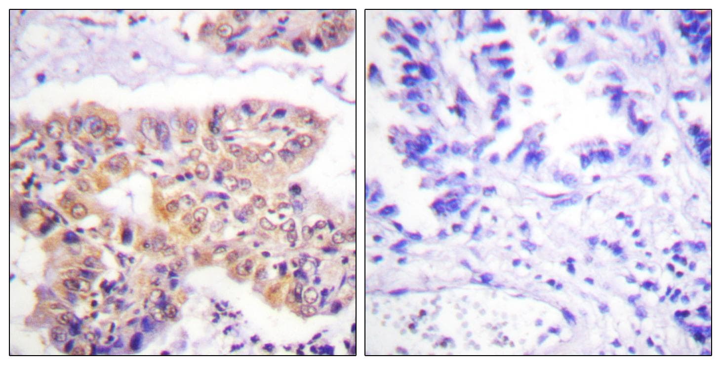 TP53 / p53 Antibody (phospho-Thr81)