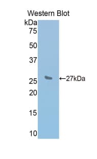 IL2RB / CD122 Antibody (aa27-240, APC)