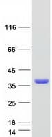 Human SMUG1 Protein (Recombinant Myc-DDK (Flag))