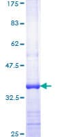 Human ZAP70 Protein (Recombinant GST, N-terminus)