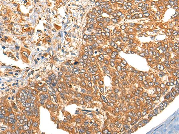 TERE1 / UBIAD1 Antibody