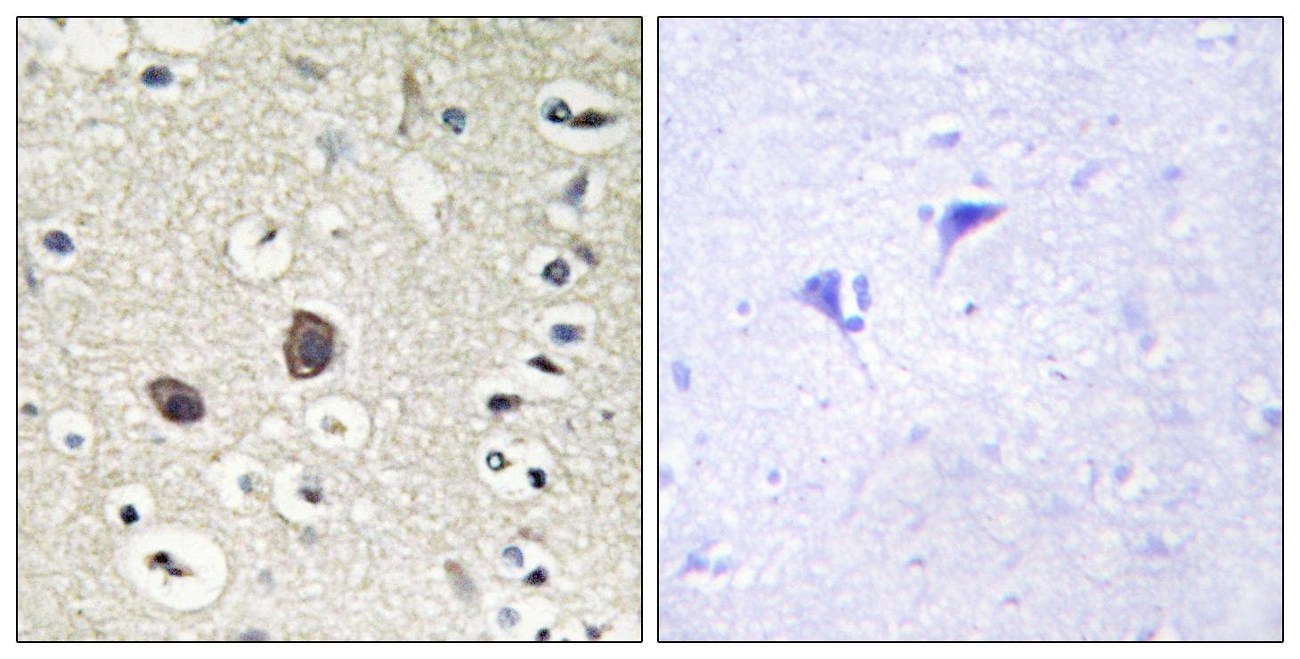TEK / TIE2 Antibody