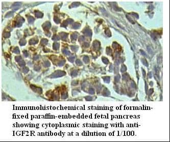 IGF2R / CD222 Antibody