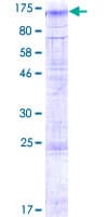 Human TMTC2 Protein (Recombinant GST)