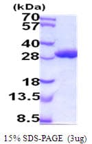 Mouse GSTA1 Protein (Recombinant His)