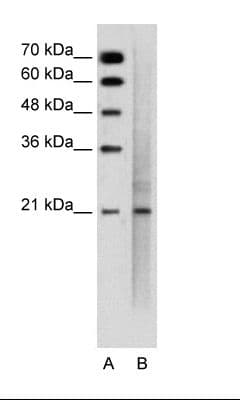 Polyclonal Rabbit anti-Human EMA / MUC1 Antibody (C-Terminus, IHC, WB)