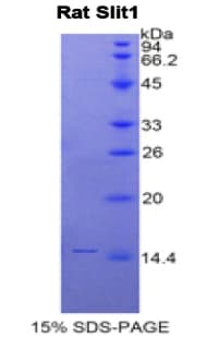 Rat SLIT1 Protein (Recombinant His)