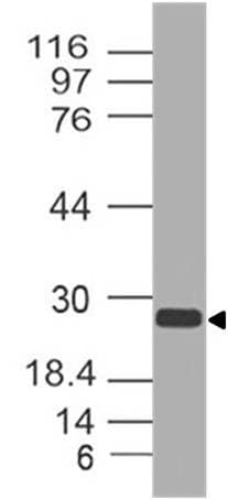 Polyclonal Rabbit anti-Human APH1A / APH-1 Antibody (WB)