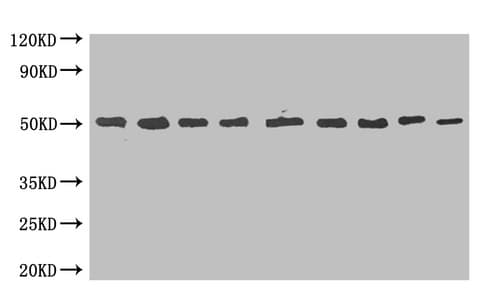 Monoclonal Mouse MBP Tag Antibody (clone 1E5C2, WB)
