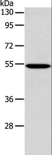 Polyclonal Rabbit anti-Human ERG Antibody (IHC, WB)
