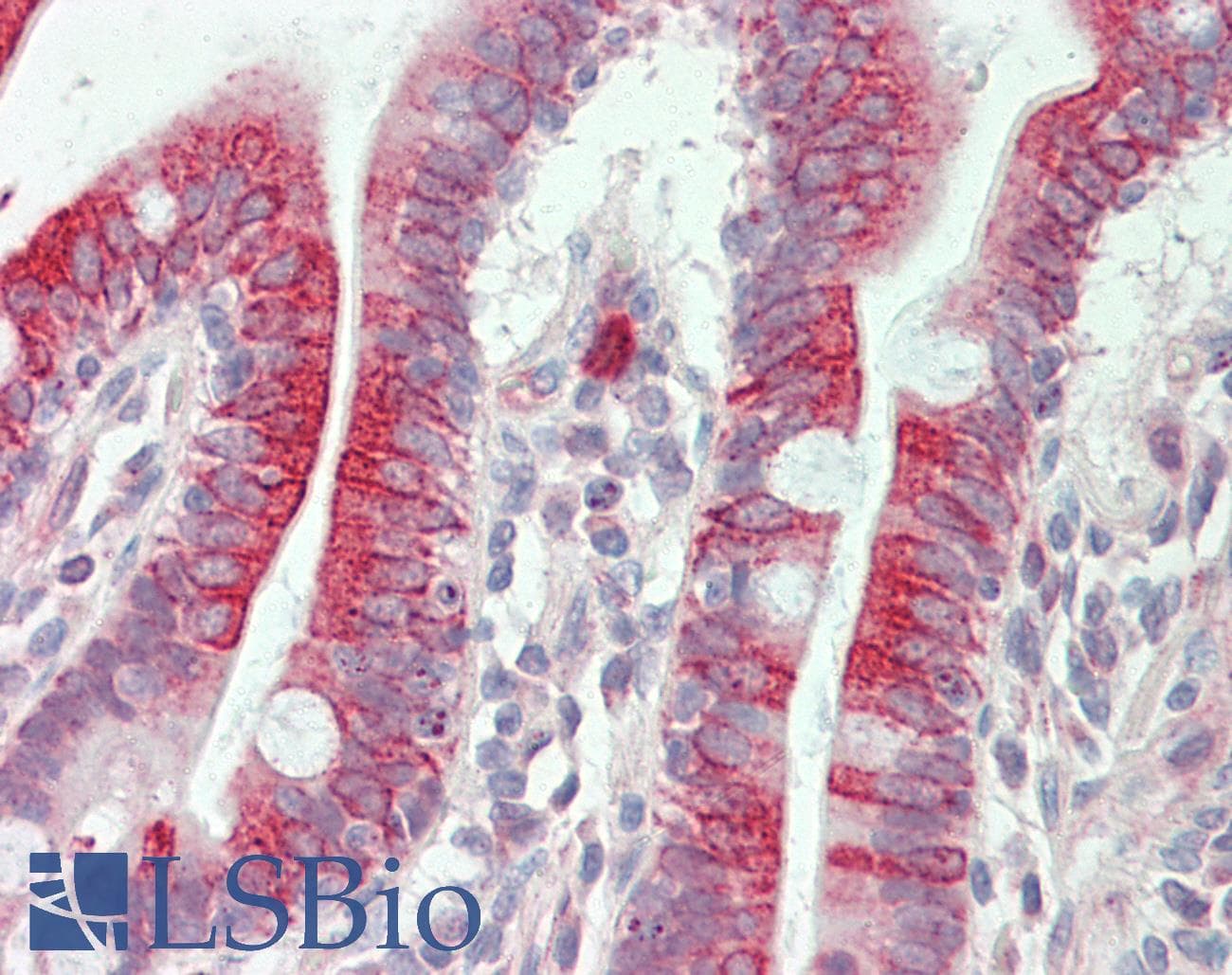 IHC-plus™ APLNR/ Apelin Receptor / APJ Antibody (aa132-181)