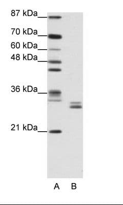 CLIC5 Antibody (C-Terminus)