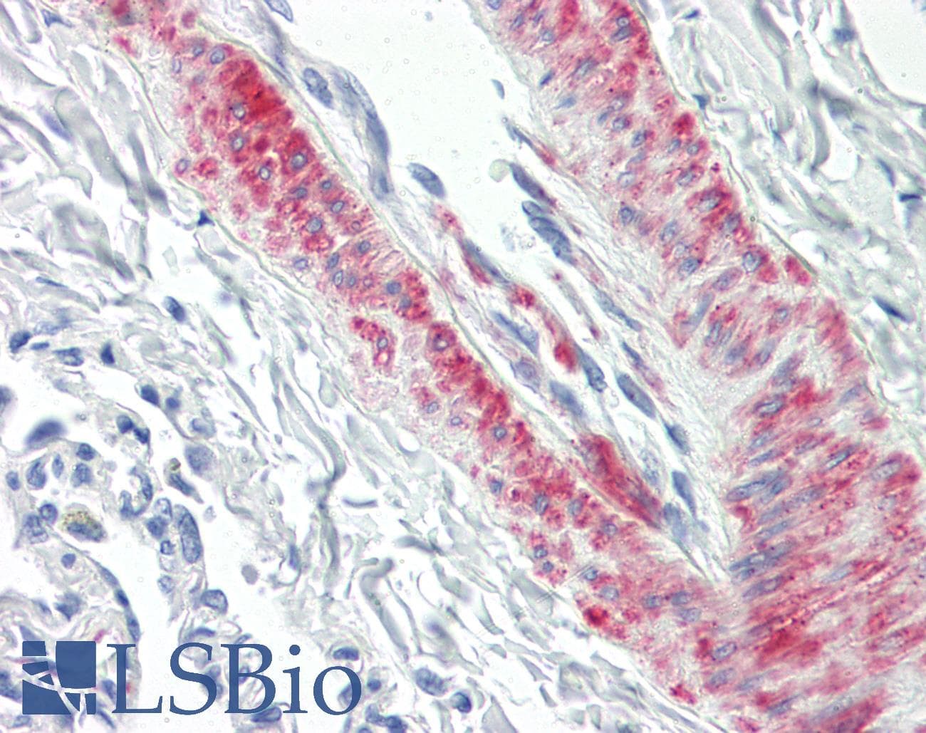 IHC-plus™ CDC42BPB / MRCKB Antibody (aa1641-1690)