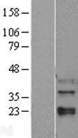 Human MAPK11 / SAPK2 / p38 Beta Protein (Over-Expression Lysate Myc-DDK (Flag))