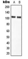 Polyclonal Rabbit anti-Human NFKB1 / NF-Kappa-B Antibody (C-Terminus, IHC, WB)