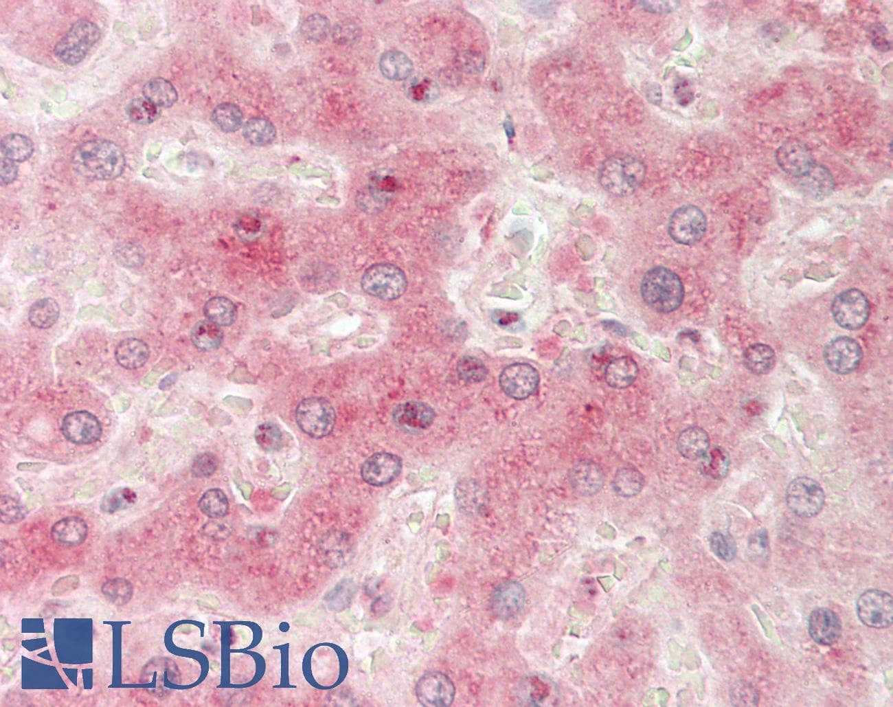SLCO5A1 Antibody (aa431-480)