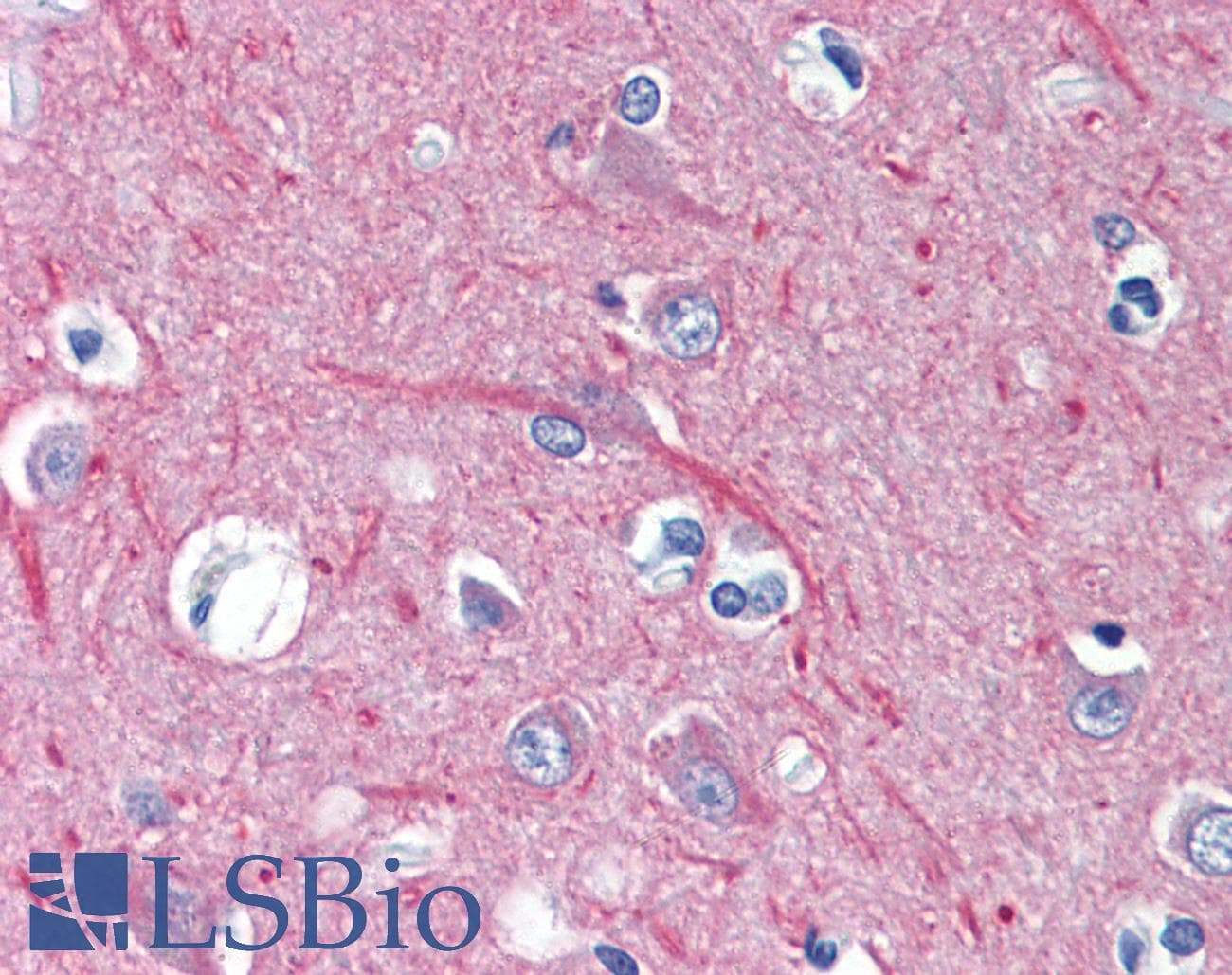 PathPlus™ TUBB / Beta Tubulin Antibody