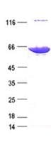 Human LRRC6 Protein (Recombinant DDK,C-terminus)