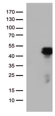 HOXD8 Antibody (aa69-290, clone OTI2B6)