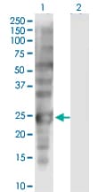 SSX1 Antibody (clone 5B2)