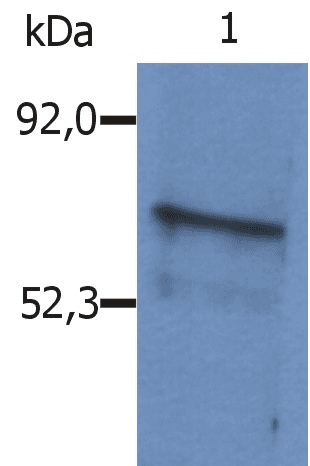 BLNK Antibody (aa171-356, clone Polyclonal)