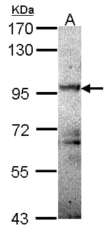 Polyclonal Rabbit anti-Human PRKD1 / PKC Mu Antibody (aa529-862, WB)