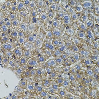 Polyclonal Rabbit anti-Mouse Mitofusin 2 / MFN2 Antibody (IHC, WB)