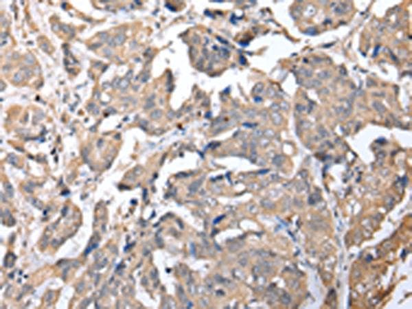 Polyclonal Rabbit anti-Human KCTD16 Antibody (IHC, WB)