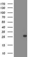 C1orf50 Antibody (clone OTI 1E1)