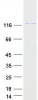 Human SEC31B Protein (Recombinant Myc-DDK (Flag))