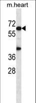 Polyclonal Rabbit anti-Mouse AKT1 Antibody (aa22-49, IHC, WB)