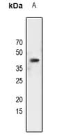 Polyclonal Rabbit anti-Human C/EBP Alpha / CEBPA Antibody (IHC, WB)