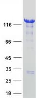 Human HDAC4 Protein (Recombinant Myc-DDK (Flag))