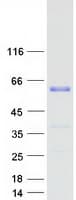 Human WTAP Protein (Recombinant Myc-DDK (Flag))