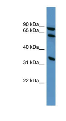 ELMO1 / ELMO 1 Antibody (aa372-421)