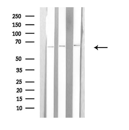 ARSE / Arylsulfatase E Antibody
