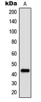 JUN / c-Jun Antibody (phospho-Thr91)