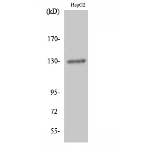 Polyclonal Rabbit anti-Human EPH Receptor B1+B2 Antibody (530-610 aa, IHC, IF, WB)