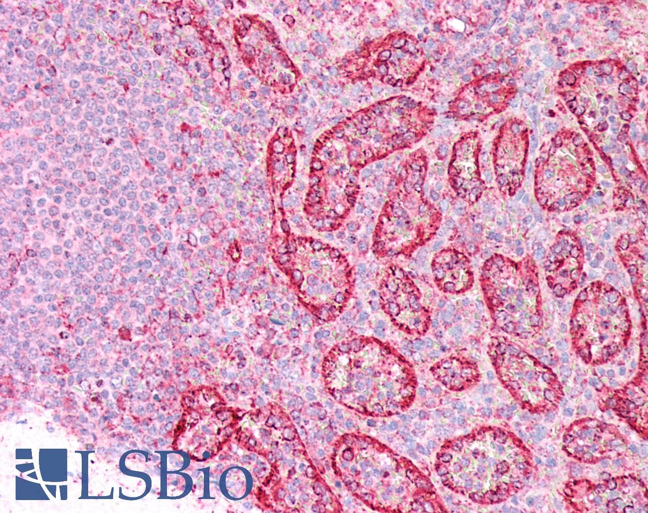 IHC-plus™ ITGB7 / Integrin Beta 7 Antibody